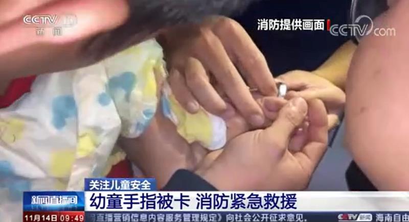 [新闻直播间]幼童手指被卡 消防紧急救援