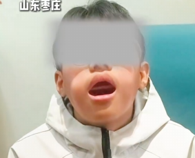 【视频】男孩贪玩把直尺放进嘴里卡住了……