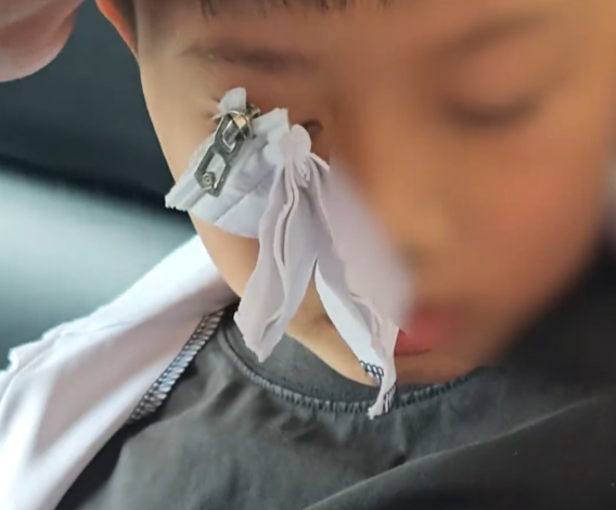 【视频】疼！校服拉链夹眼皮 消防员细心解救